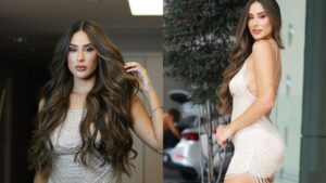 Ex-BBB Deniziane mostra antes e depois de cirurgias plásticas: 'Eu amei'