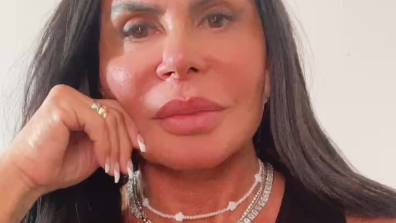 Gretchen retira preenchimento labial feito há mais de 20 anos; veja o porquê