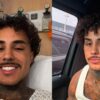 MC Livinho perfura pulmão após acidente de moto em São Paulo