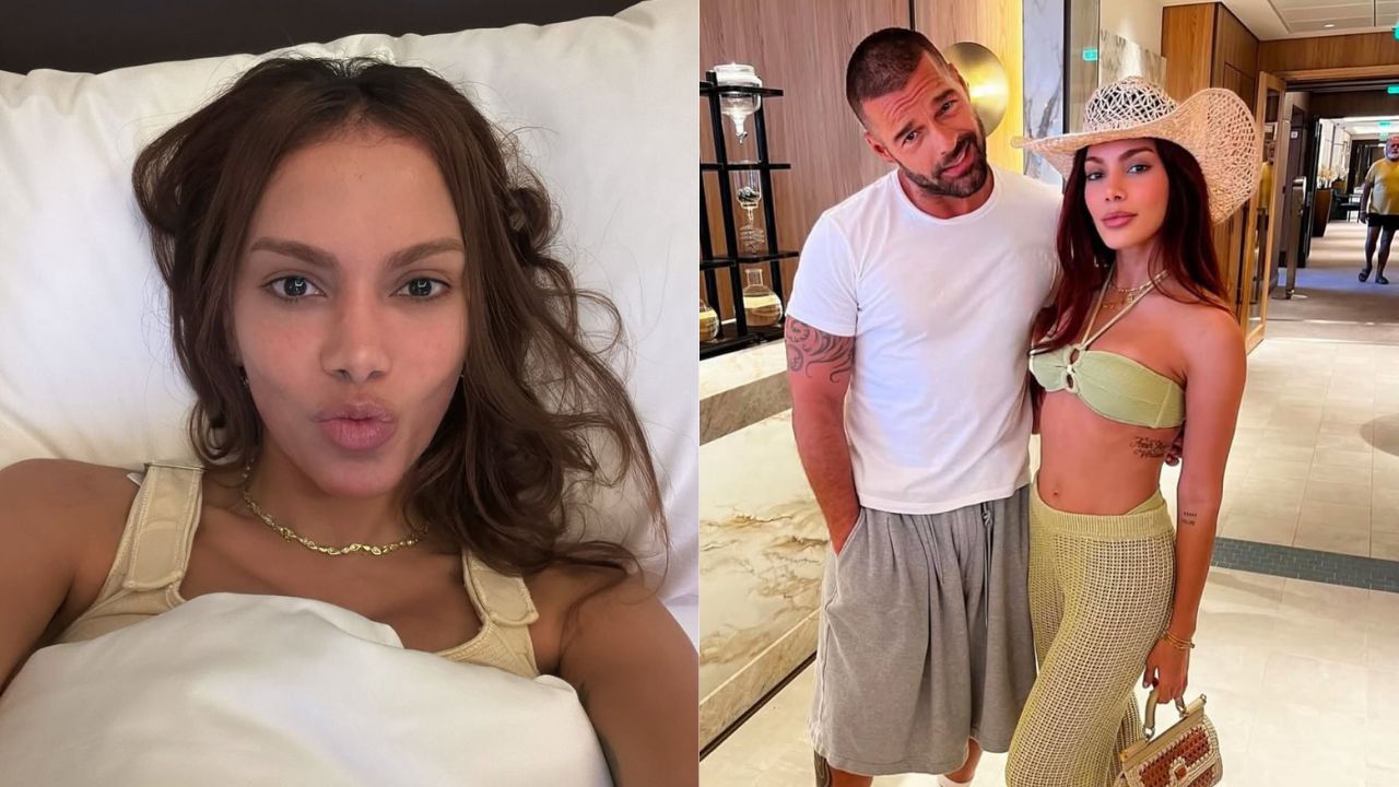 O que Anitta fez no rosto? Veja todos os procedimentos